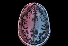 No, Science Hasn’t Found a “Transgender Brain”
